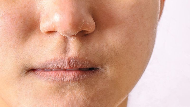 Do tình trạng da mỗi người